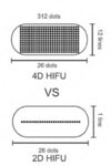 4D HIFU 4 σε 1 πλατφόρμα για λίφτινγκ, περίγραμμα ματιών, κολπική σύσφιξη και λιποσόνια