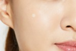 Cosrx Acne Pimple Master Patch-пачове за пъпки (COSRX - Acne Pimple Master Patch)