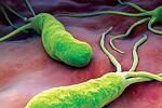 Как да се предпазим от Хеликобактер Пилори, бактерията която започна да тормози толкова много хора