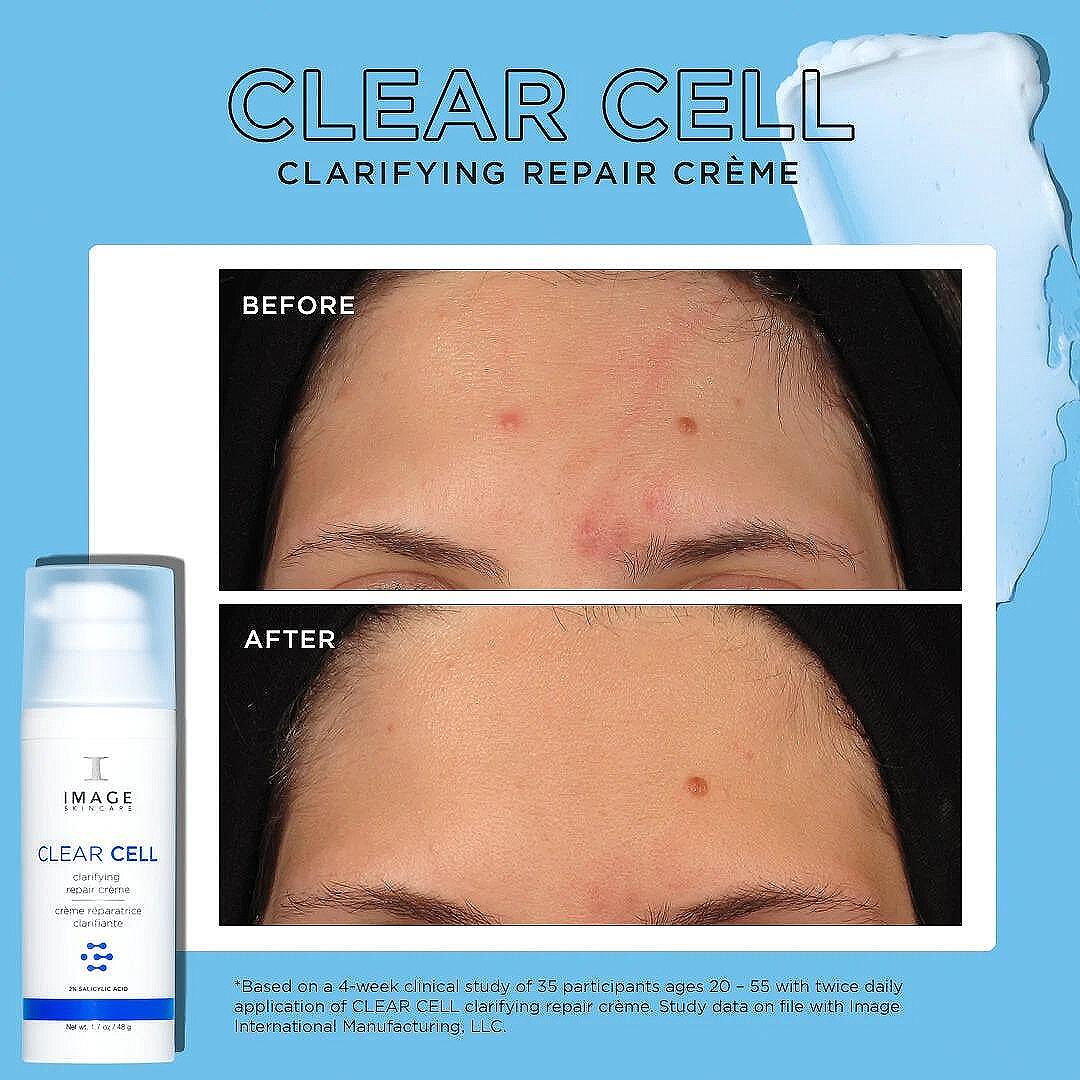 Възстановяващ гел крем за акне и възпалена кожа Image Skincare Clear Cell Clarifying Repair Creme