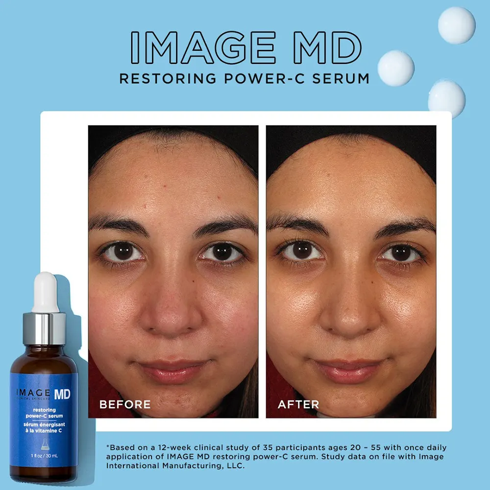 Хидратиращ серум за лице с Витамин С и хиалуронова киселина IMAGE MD Clinical Skincare Restoring Power-C Serum