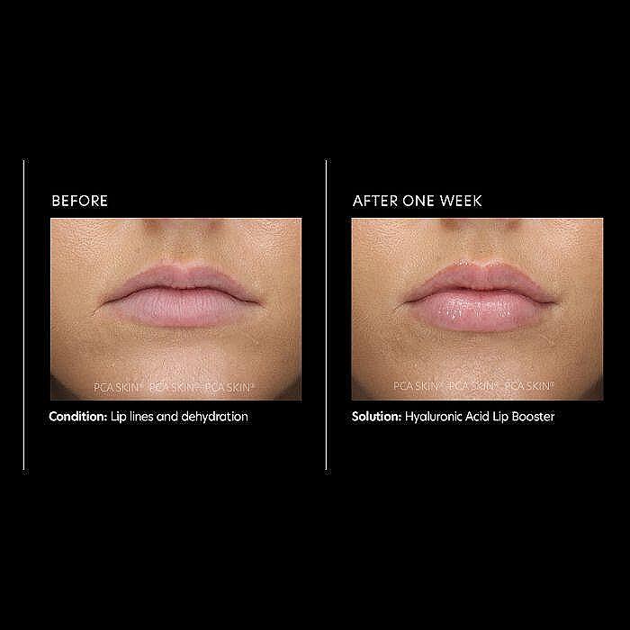 Пептидна хиалуронова терапия за обемни устни PCA Skin Hyaluronic Acid Lip Booster
