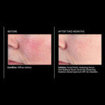 Серум против зачервявания и възпаления PCA Skin Anti-Redness Serum