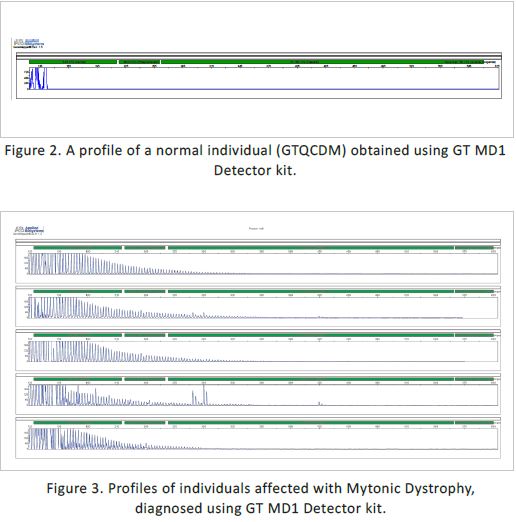 Myotonic Dystrophy (MD1) Detector kit