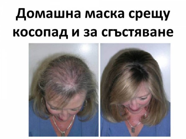 Домашна маска срещу косопад за сгъстяване на косата и по-бърз растеж