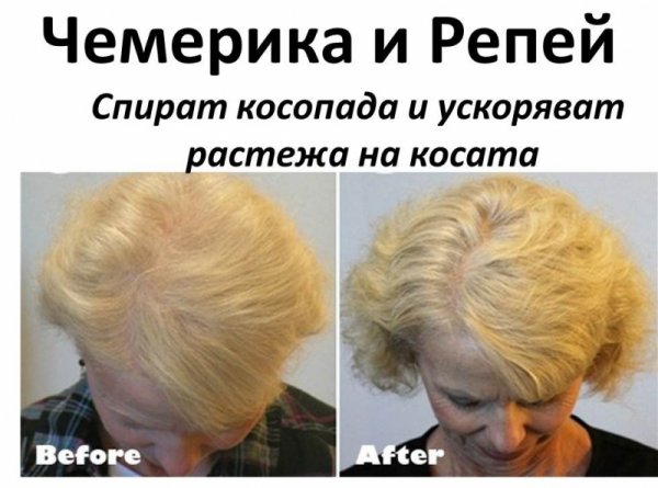 Чемерика и репей – билките, които спират косопада и ускоряват растежа на косата