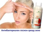 Антибактериален лосион срещу акне losion-sreshtu-akne-belezi-petna