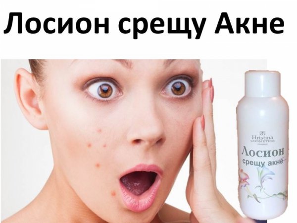Антибактериален лосион срещу акне